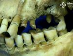 انسان‌های اولیه هم دچار مشکلات دندان مشابه ما می‌گشتند