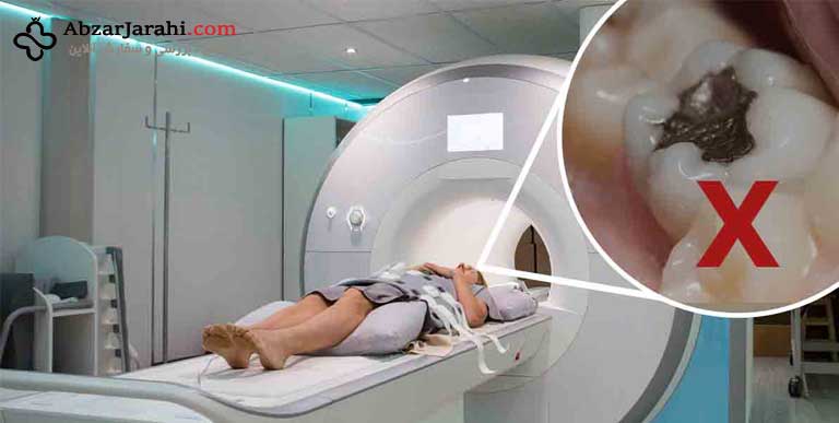 دستگاه‌های MRI جدید باعث نشت جیوه از دندان پرشده می‌گردد !
